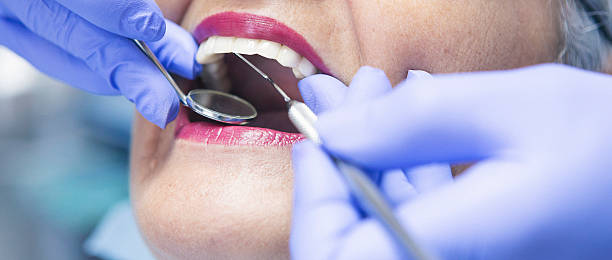 Best Emergency Treatment for Dental Infections or Abscesses in East Berwick, PA